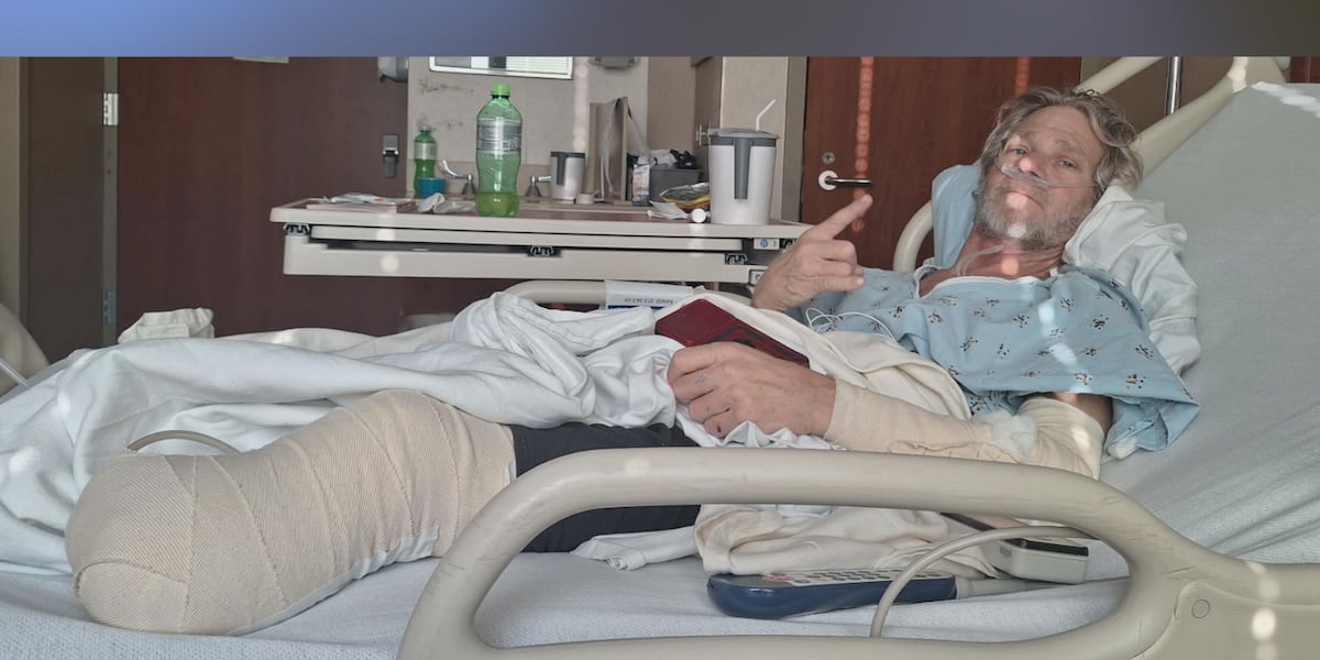 Rob Rast Leg Injury ‘We’ve got to … find justice’: Motorcyclist loses part of leg, friend ...