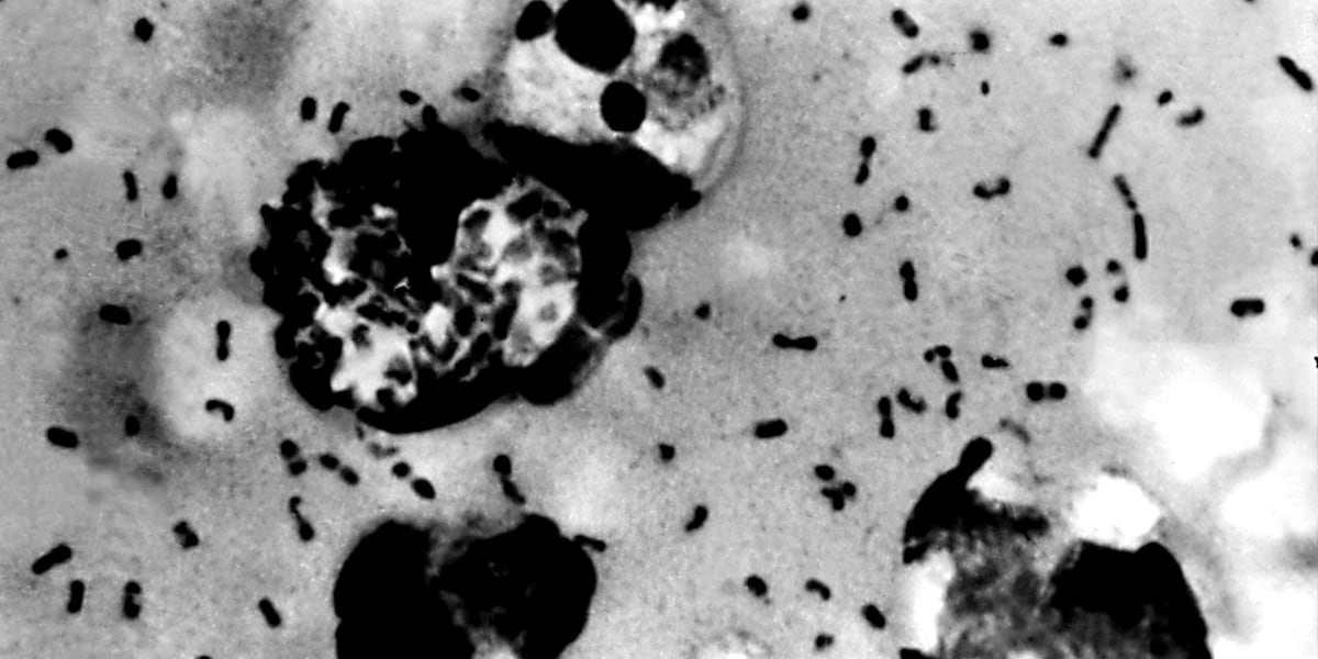 Plague suspected in southern Colorado county following mass prairie dog die-off Plague suspected in southern Colorado county following mass prairie dog die-off