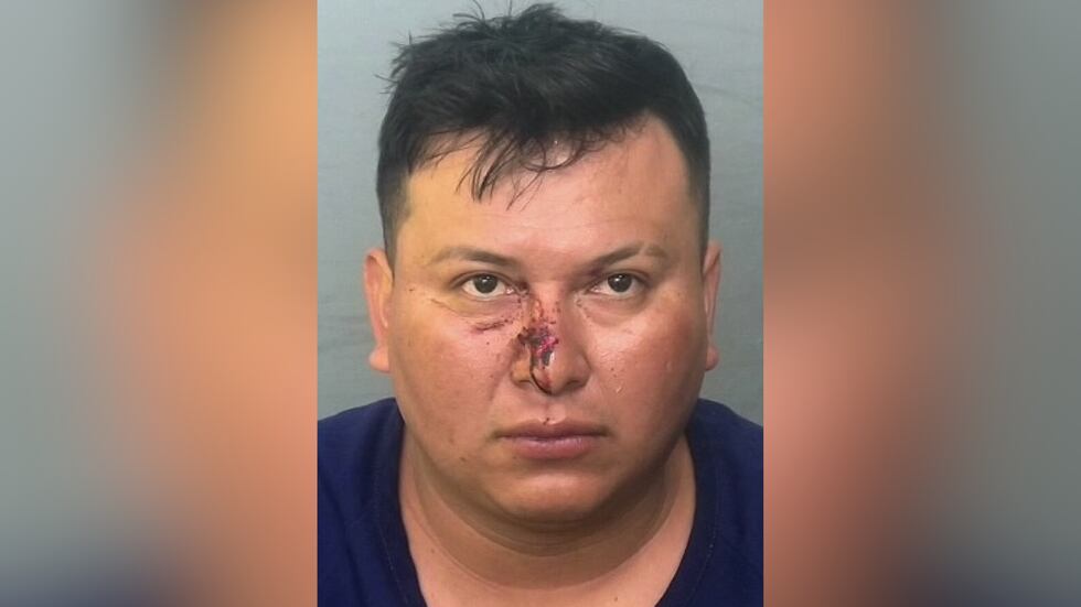 Laurentino Serrano-Juarez Arrested; Suspected DUI driver kills unborn baby in head-on crash, seriously injures mother, police say Laurentino Serrano-Juarez, 31, is facing charges related to a DUI crash.