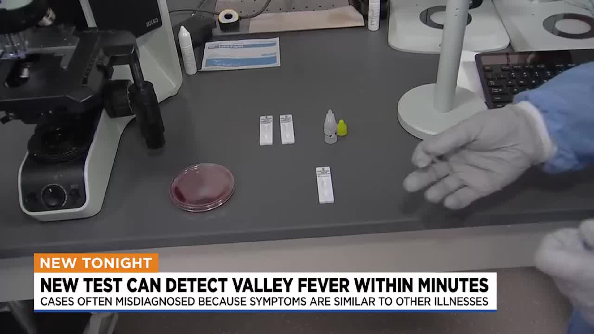 Mayo Clinic Unveils Rapid Test to Transform Valley Fever Diagnosis